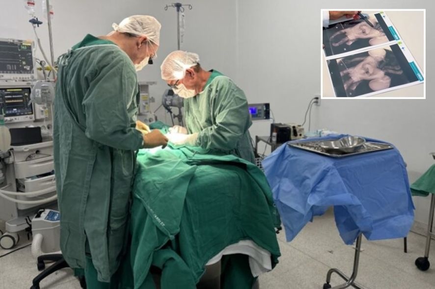 Tragédia em Goiás: Gêmeos Siameses de MT Perdem a Vida Após Cirurgia Tragédia em Goiás: Gêmeos Siameses de MT Perdem a Vida Após Cirurgia